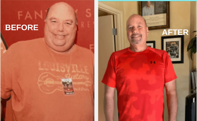 Weight Loss – Before & After